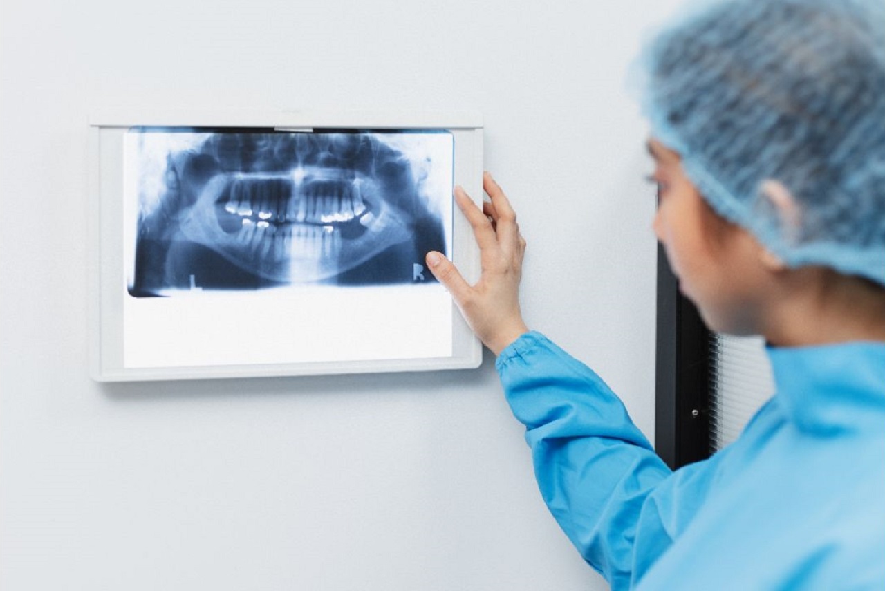 Are Dentist X Rays Safe