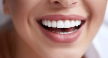 Expert Guide: Say Goodbye to Teeth Whitening White Spots