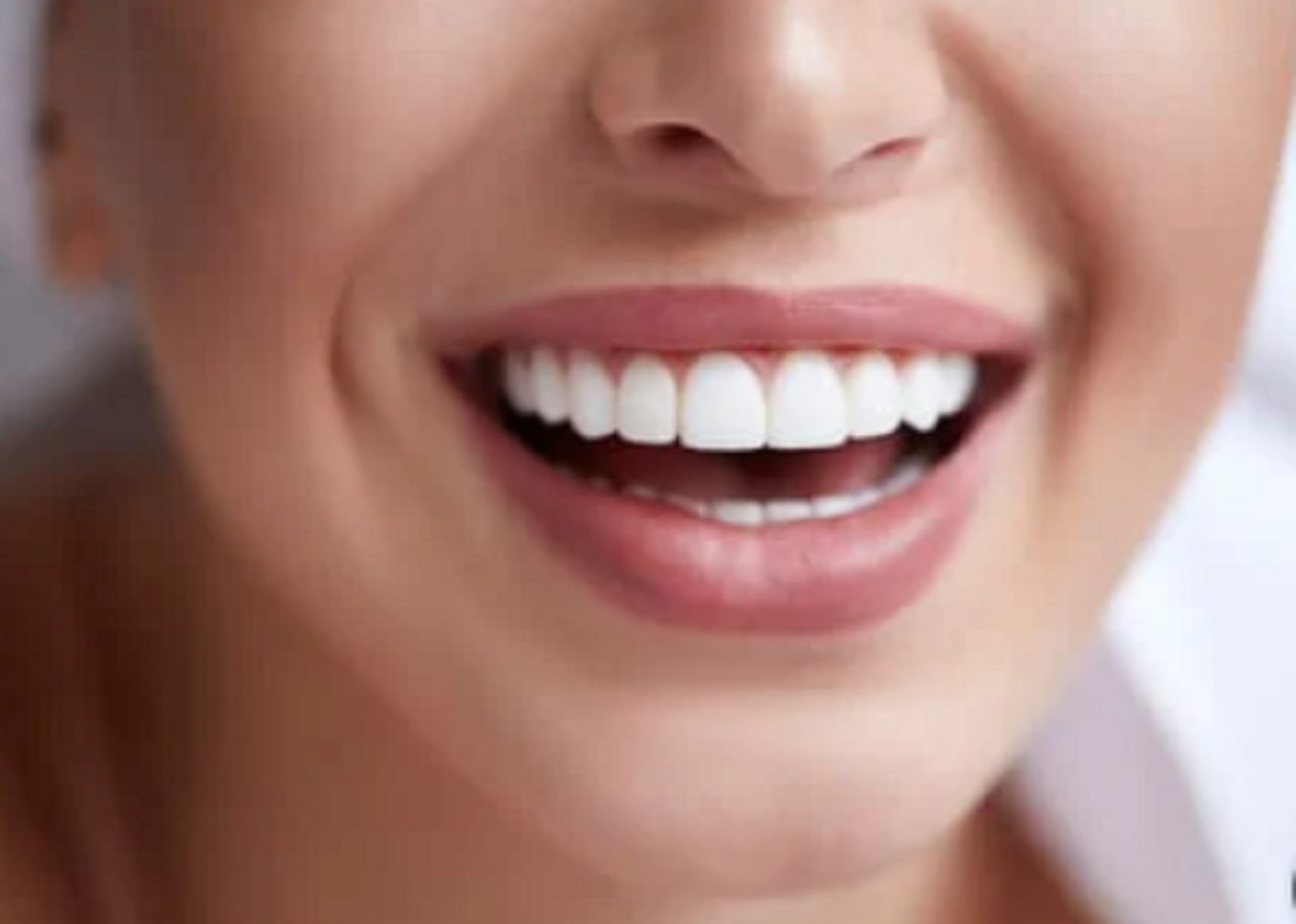 Teeth Whitening White Spots