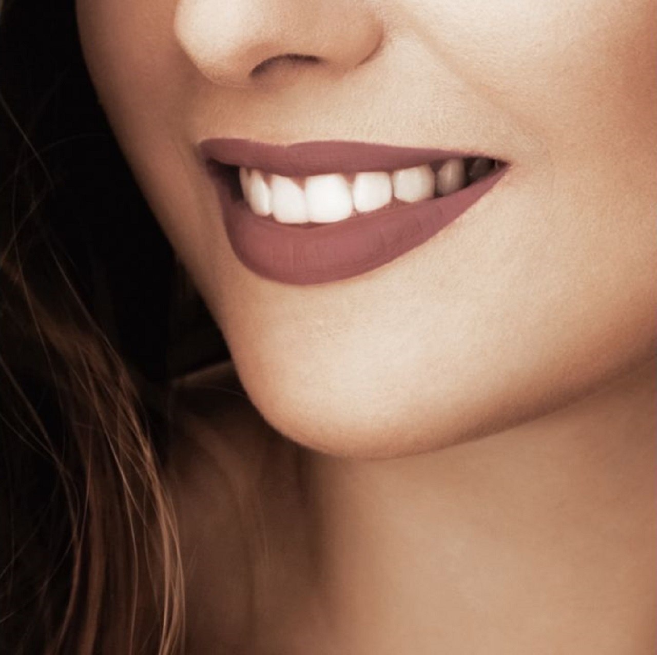 What Insurance Covers Cosmetic Dentistry